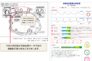 血管推定年齢測定