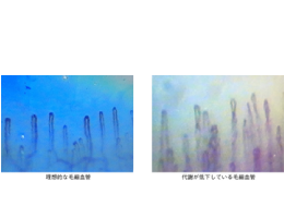 毛細血管のイメージ